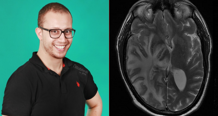 تونسي مقيم بالنرويج يفوز بالجائزة الاولى في مسابقة للذكاء الاصطناعي للكشف على سرطان المخ